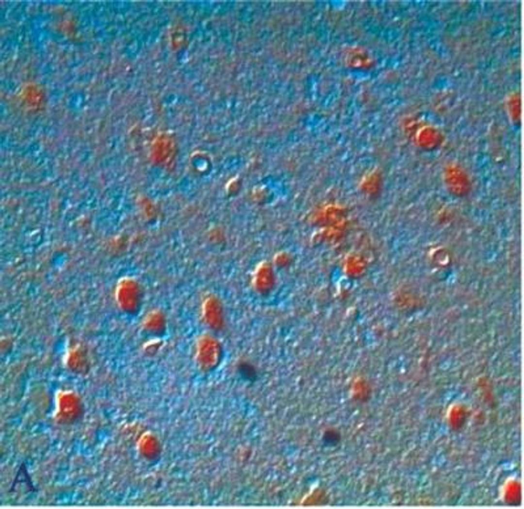 Immunohistochemistry: 8-Hydroxyguanosine Antibody [NB600-1508] - Goat anti-8-OHdG Alzheimer disease brain showing immunohistochemical staining of oxidized DNA in neurons. Tissue sections were formalin-fixed, paraffin-embedded with either (A) no pretreatment, or (B) pretreated with 10 mg/mL proteinase K for 40 minutes at 37 degrees C. and stained with a 1:200 dilution of AB5830.