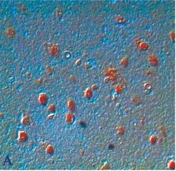 Immunohistochemistry: 8-Hydroxyguanosine Antibody [NB600-1508] - Goat anti-8-OHdG Alzheimer disease brain showing immunohistochemical staining of oxidized DNA in neurons. Tissue sections were formalin-fixed, paraffin-embedded with either (A) no pretreatment, or (B) pretreated with 10 mg/mL proteinase K for 40 minutes at 37 degrees C. and stained with a 1:200 dilution of AB5830.