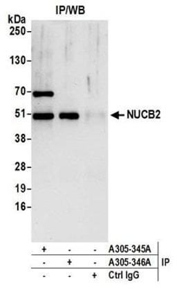 Detection of human NUCB2 by western blot of immunoprecipitates.