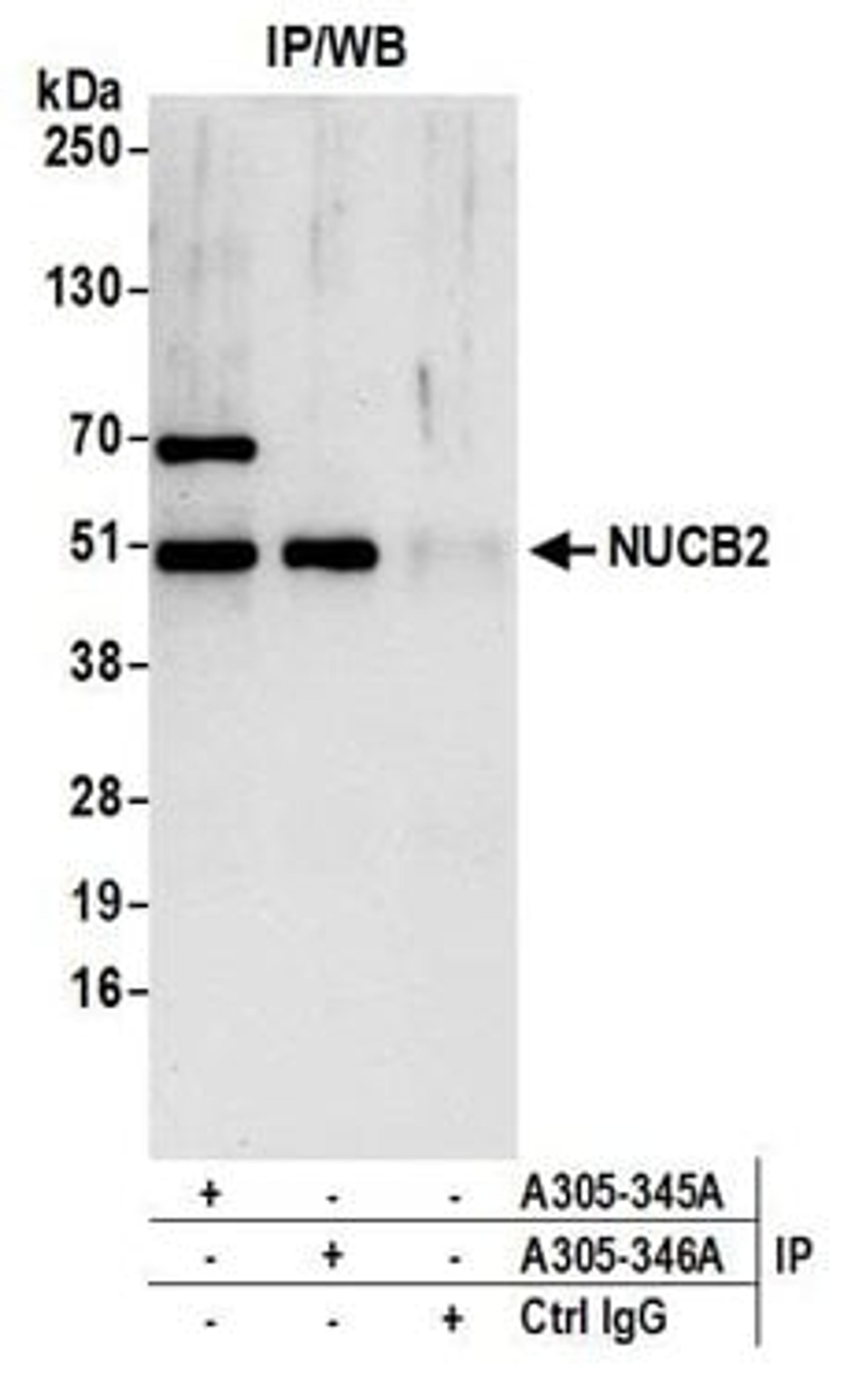 Detection of human NUCB2 by western blot of immunoprecipitates.