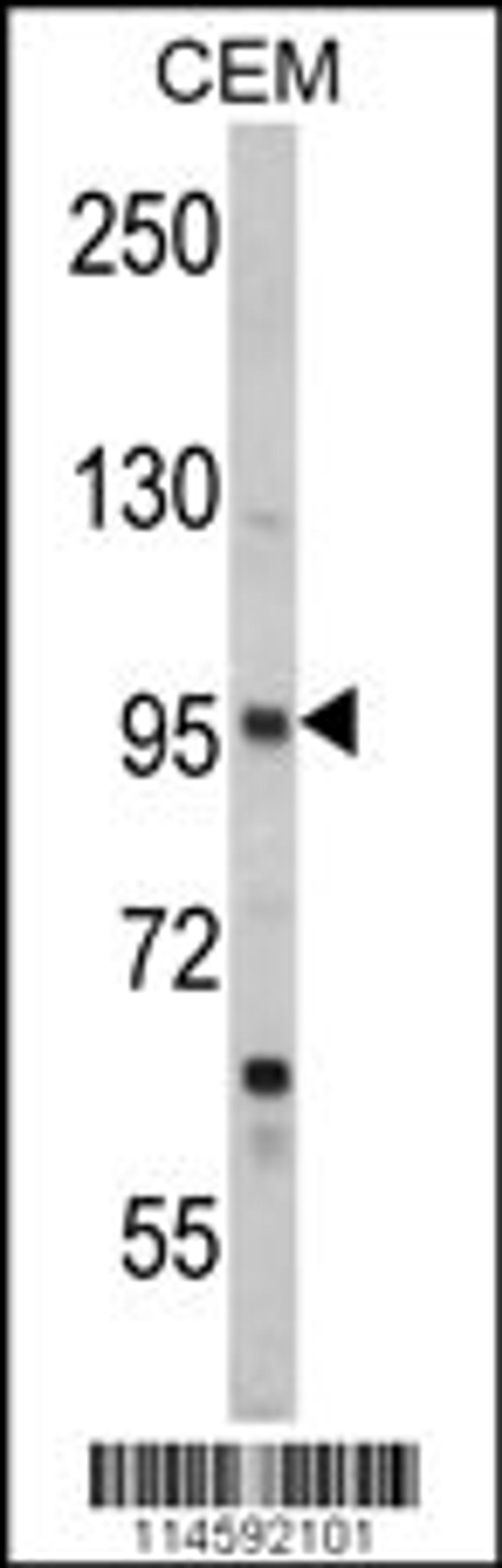 Western blot analysis of SEMA3A Antibody in CEM cell line lysates (35ug/lane)