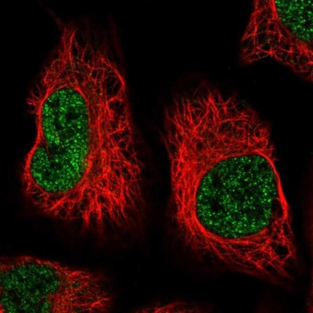 Immunocytochemistry/Immunofluorescence: AIM1L Antibody [NBP1-90618] - Staining of human cell line U-2 OS shows positivity in nucleus but not nucleoli.