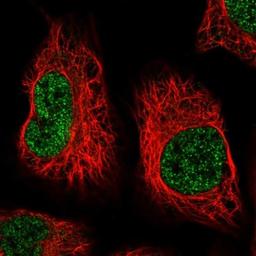 Immunocytochemistry/Immunofluorescence: AIM1L Antibody [NBP1-90618] - Staining of human cell line U-2 OS shows positivity in nucleus but not nucleoli.