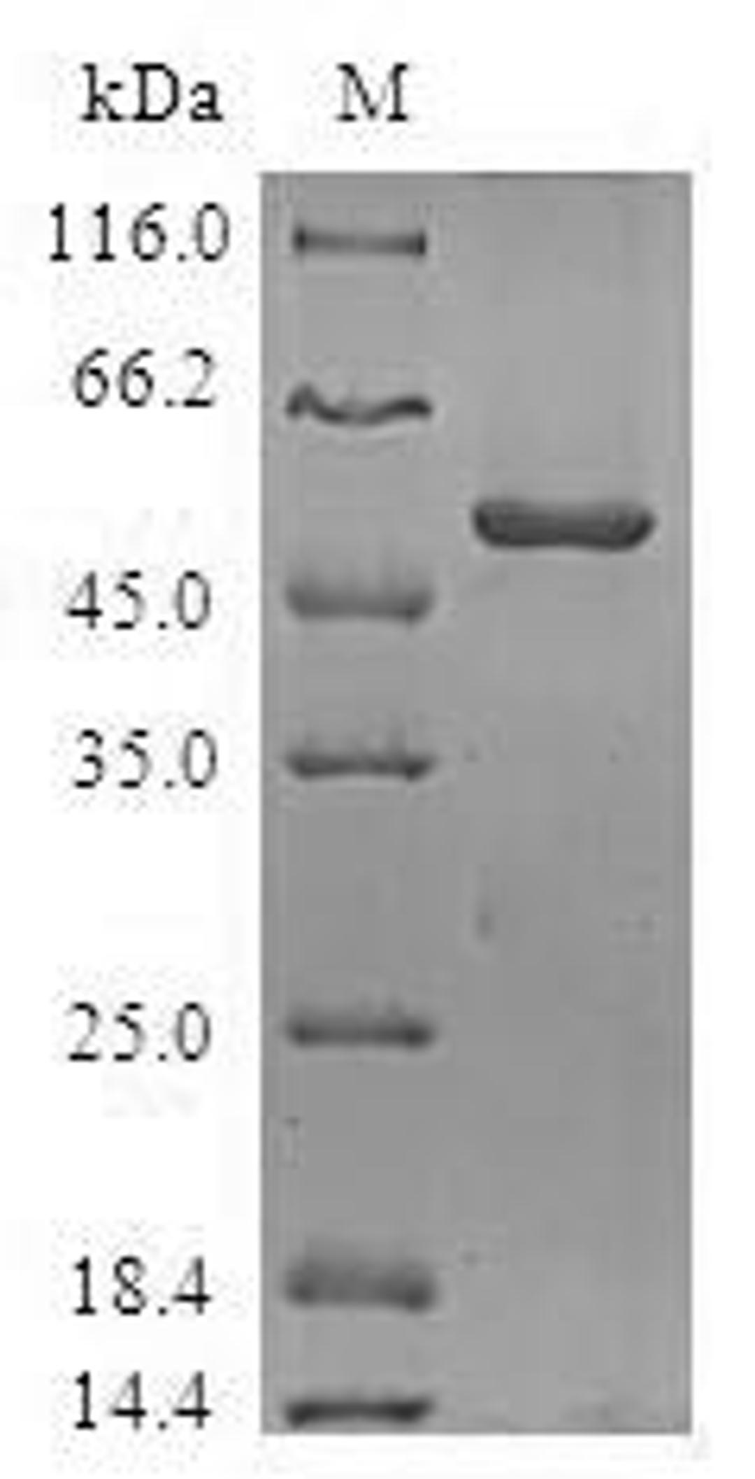 (Tris-Glycine gel) Discontinuous SDS-PAGE (reduced) with 5% enrichment gel and 15% separation gel.