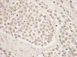 Detection of human SRPK1 by immunohistochemistry.