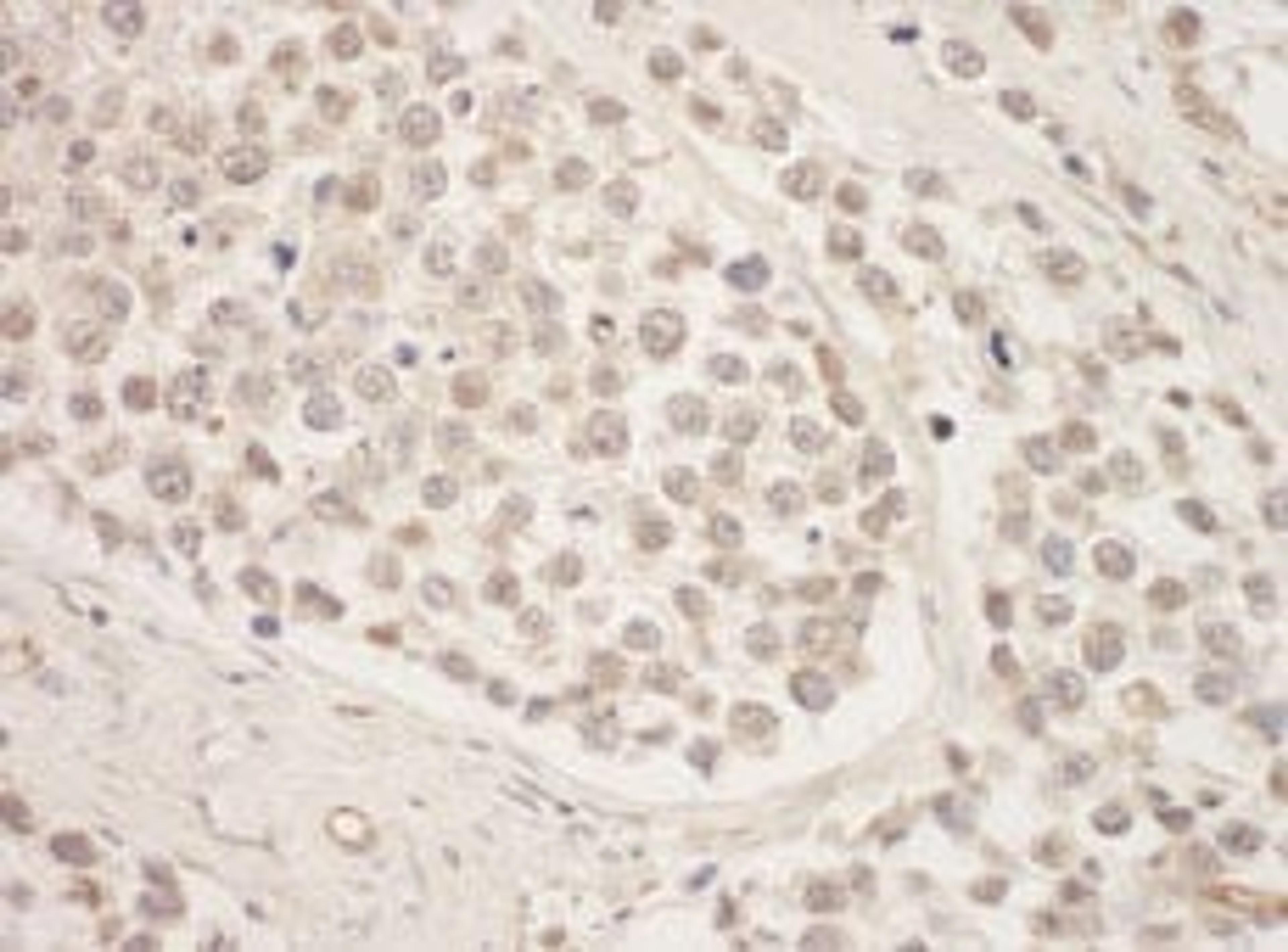 Detection of human SRPK1 by immunohistochemistry.