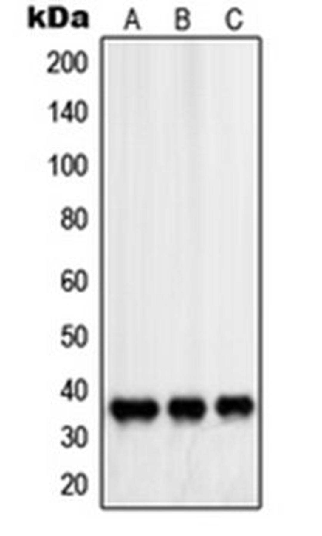 Western blot analysis of HeLa (Lane 1), Saos2 (Lane 2), NIH3T3 (Lane 3) whole cell lysates using PDLIM1 antibody