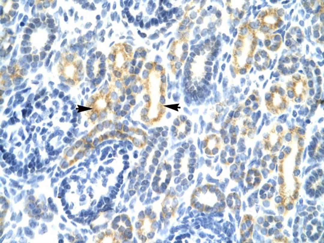 Antibody used in IHC on Human kidney.