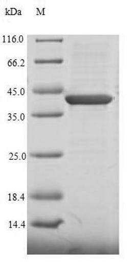 (Tris-Glycine gel) Discontinuous SDS-PAGE (reduced) with 5% enrichment gel and 15% separation gel.