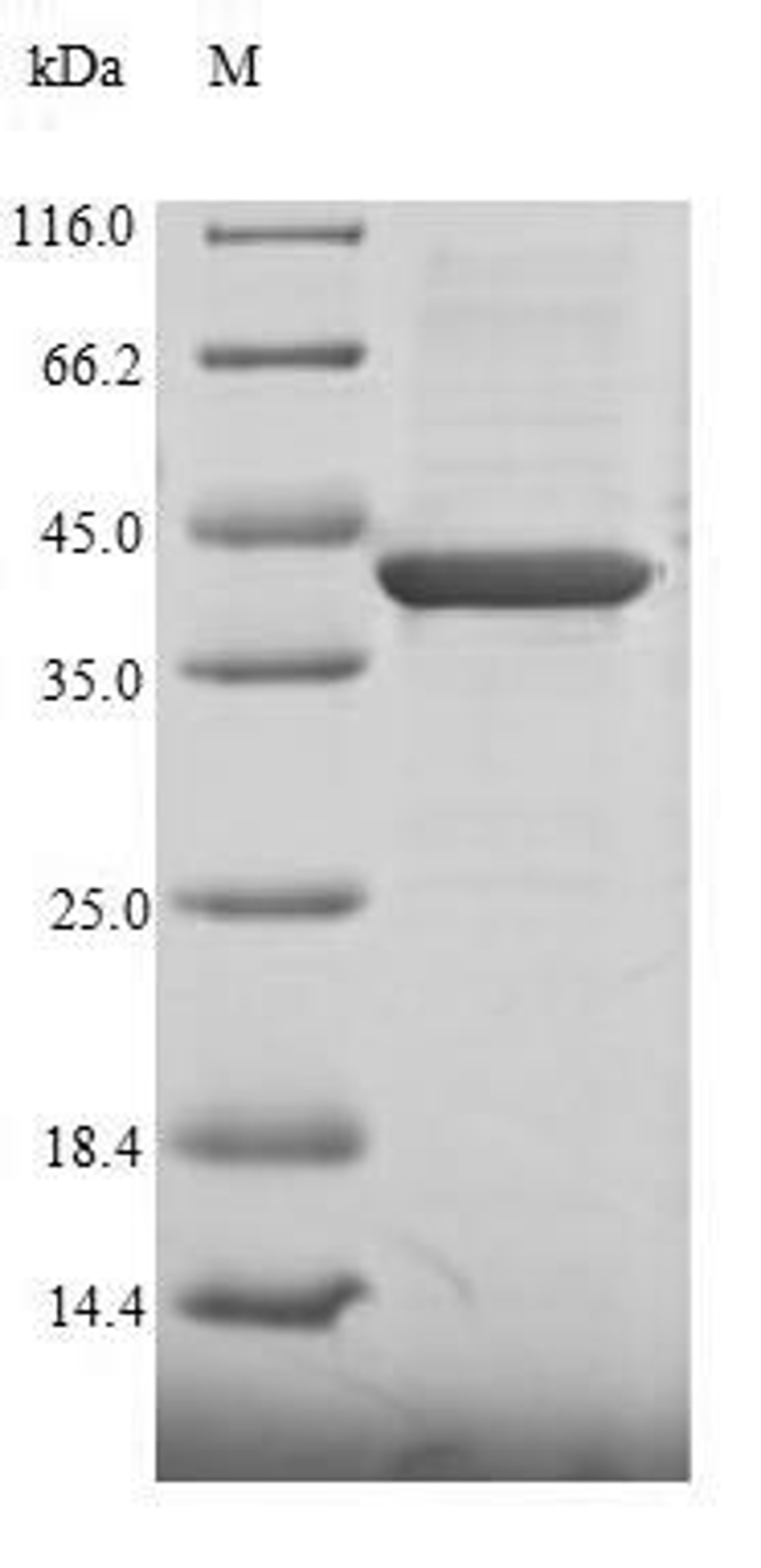 (Tris-Glycine gel) Discontinuous SDS-PAGE (reduced) with 5% enrichment gel and 15% separation gel.