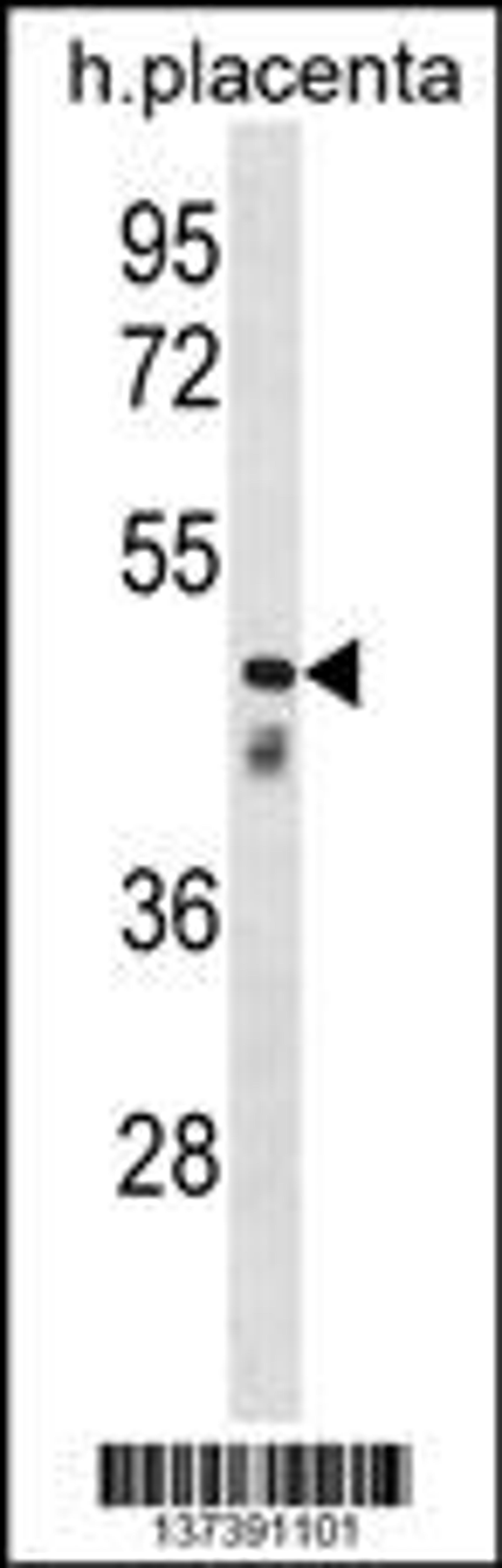 Western blot analysis in human placenta tissue lysates (35ug/lane).