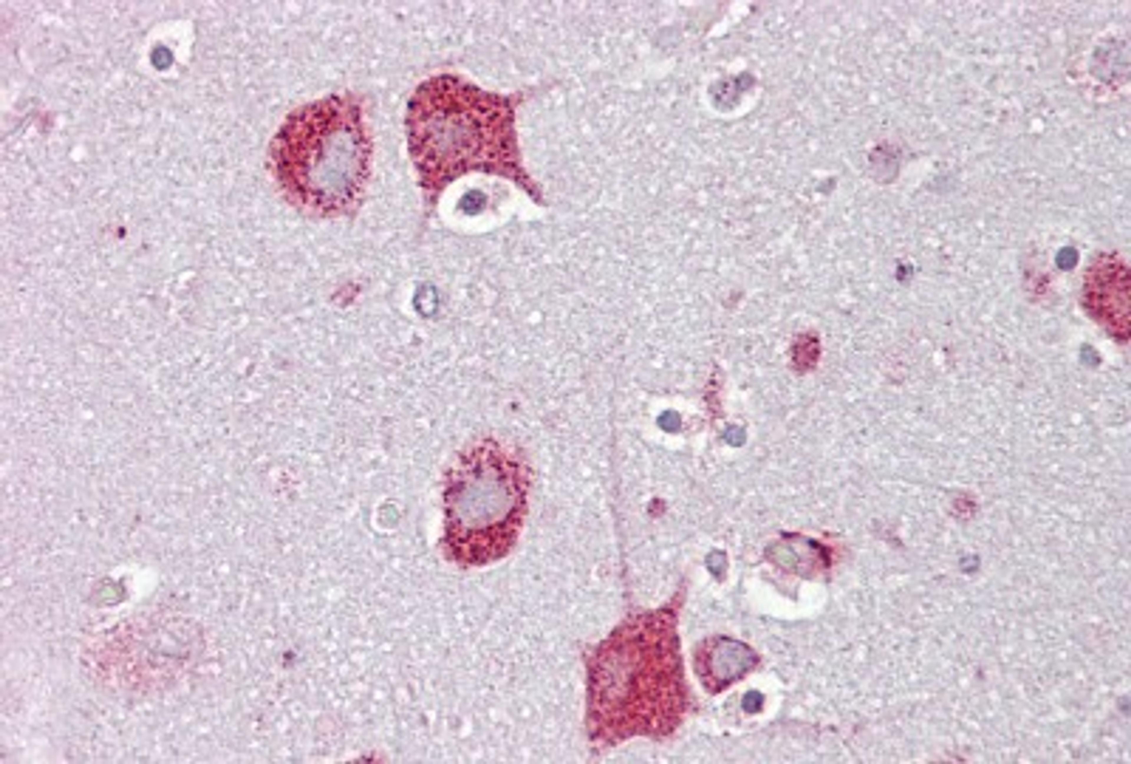 Immunohistochemistry-Paraffin: HEXA Antibody [NBP1-74127] - Human Brain, cortex tissue at an antibody concentration of 5ug/ml.