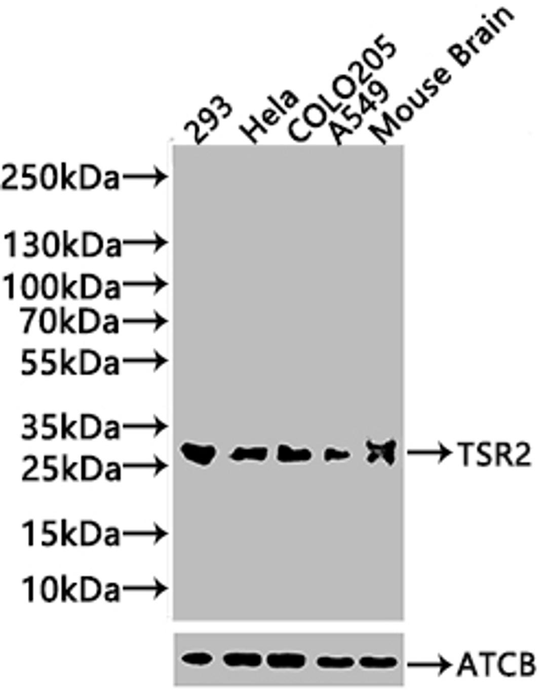 Western Blot. Positive WB detected in: HEK293 whole cell lysate. All lanes: TSR2 antibody at 2µg/ml. Secondary. Goat polyclonal to rabbit IgG at 1/50000 dilution. Predicted band size: 21 kDa. Observed band size: 21 kDa