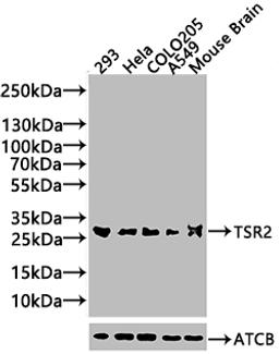 Western Blot. Positive WB detected in: HEK293 whole cell lysate. All lanes: TSR2 antibody at 2µg/ml. Secondary. Goat polyclonal to rabbit IgG at 1/50000 dilution. Predicted band size: 21 kDa. Observed band size: 21 kDa