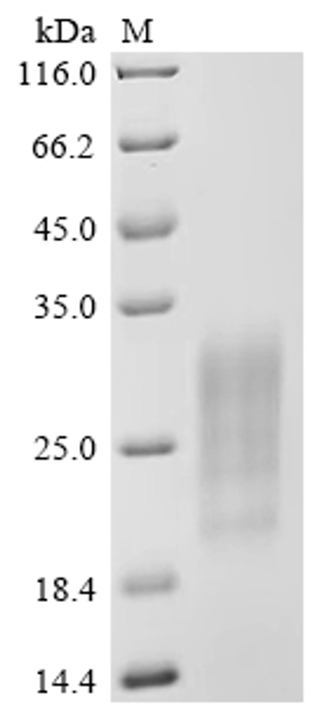 (Tris-Glycine gel) Discontinuous SDS-PAGE (reduced) with 5% enrichment gel and 15% separation gel.