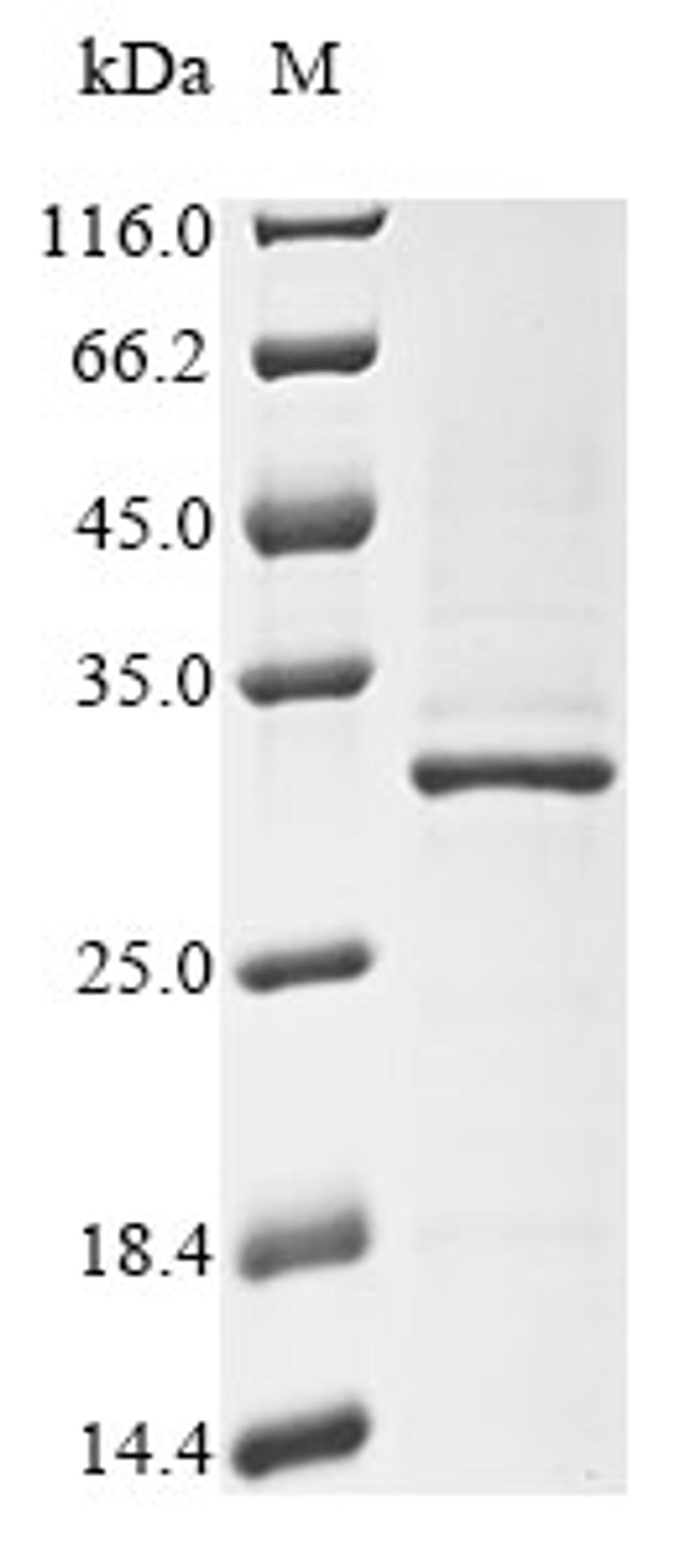 (Tris-Glycine gel) Discontinuous SDS-PAGE (reduced) with 5% enrichment gel and 15% separation gel.