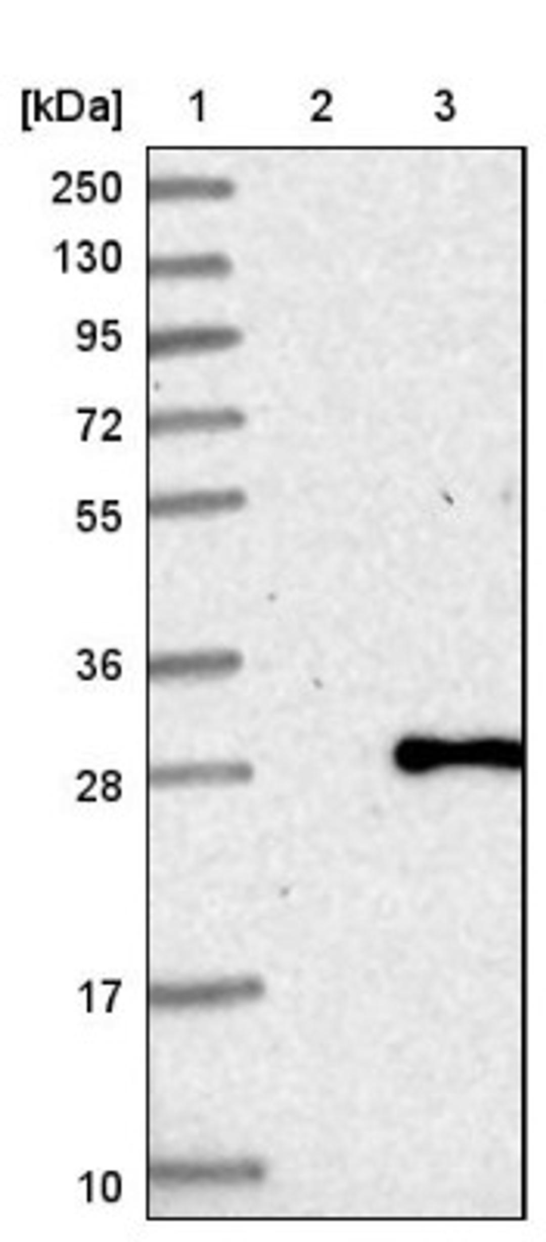 Western Blot: PCNP Antibody [NBP1-86312] - Lane 1: Marker [kDa] 250, 130, 95, 72, 55, 36, 28, 17, 10<br/>Lane 2: Negative control (vector only transfected HEK293T lysate)<br/>Lane 3: Over-expression lysate (Co-expressed with a C-terminal myc-DDK tag (~3.1 kDa) in mammalian HEK293T cells, LY412527)