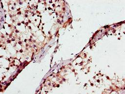Immunohistochemistry of paraffin-embedded human testis tissue using CSB-PA865134LA01HU at dilution of 1:100
