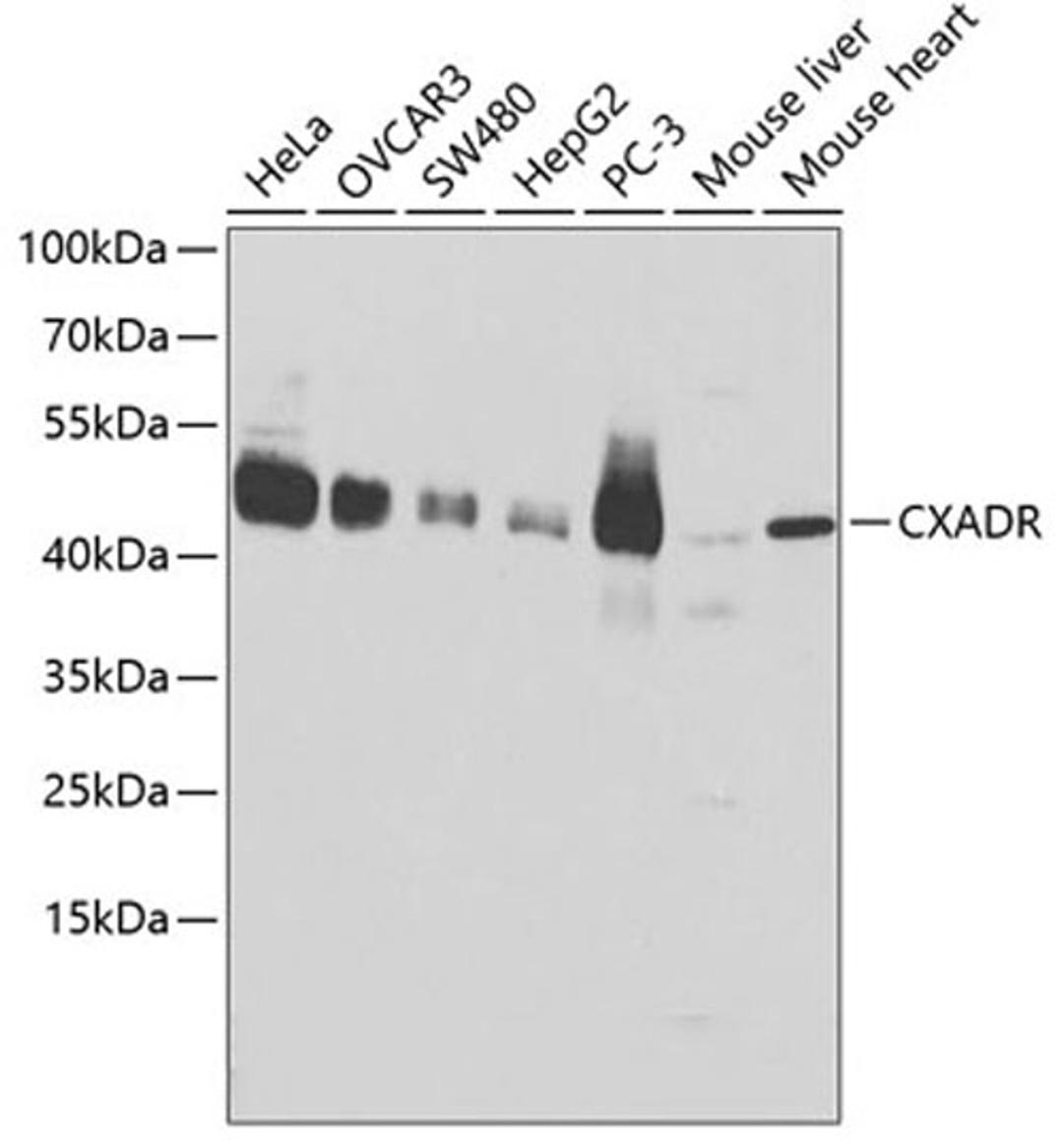 Western blot - CXADR antibody (A1822)