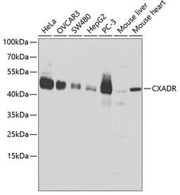 Western blot - CXADR antibody (A1822)