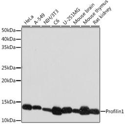 Western blot - Profilin1 Rabbit mAb (A9188)