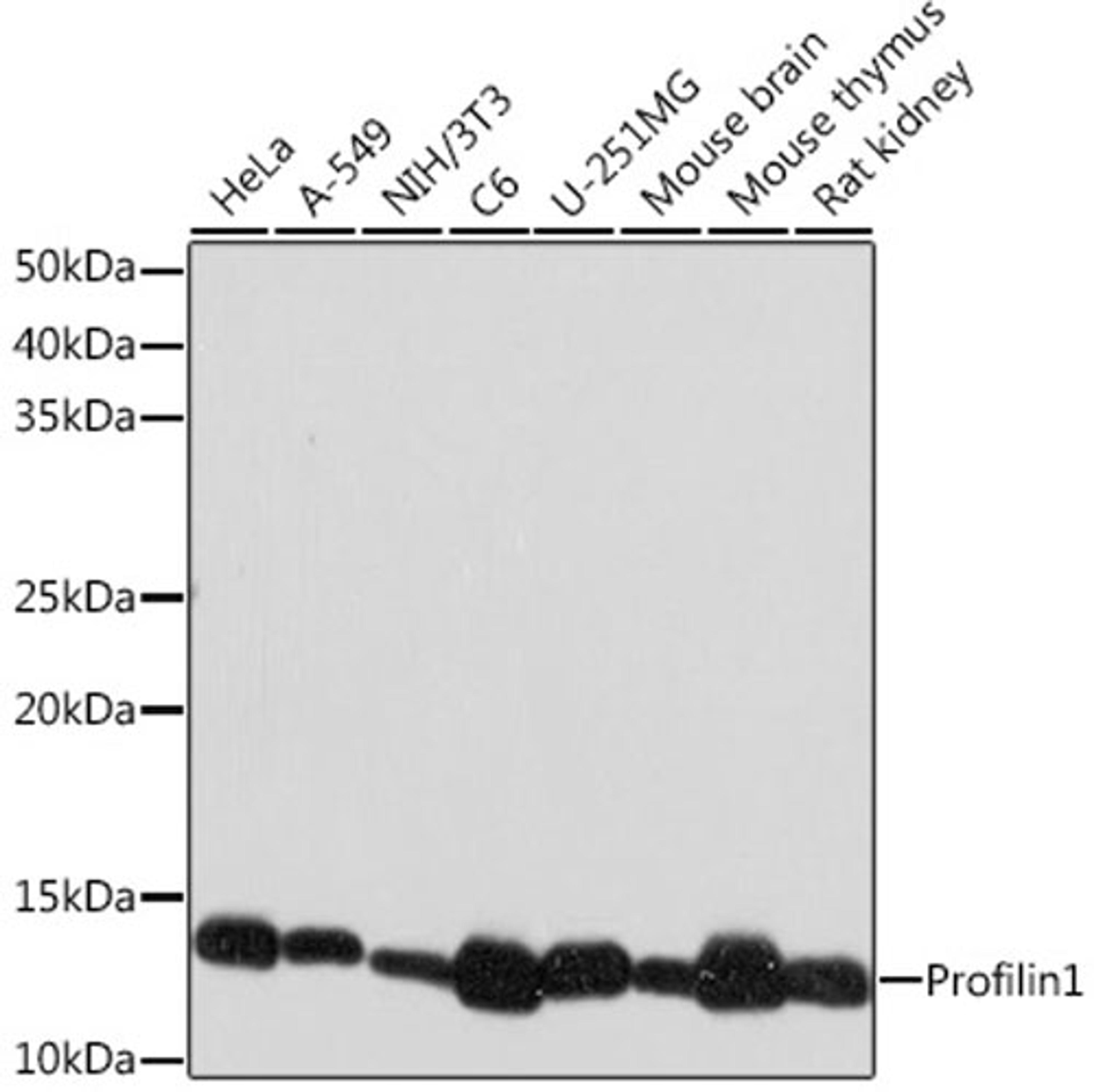 Western blot - Profilin1 Rabbit mAb (A9188)