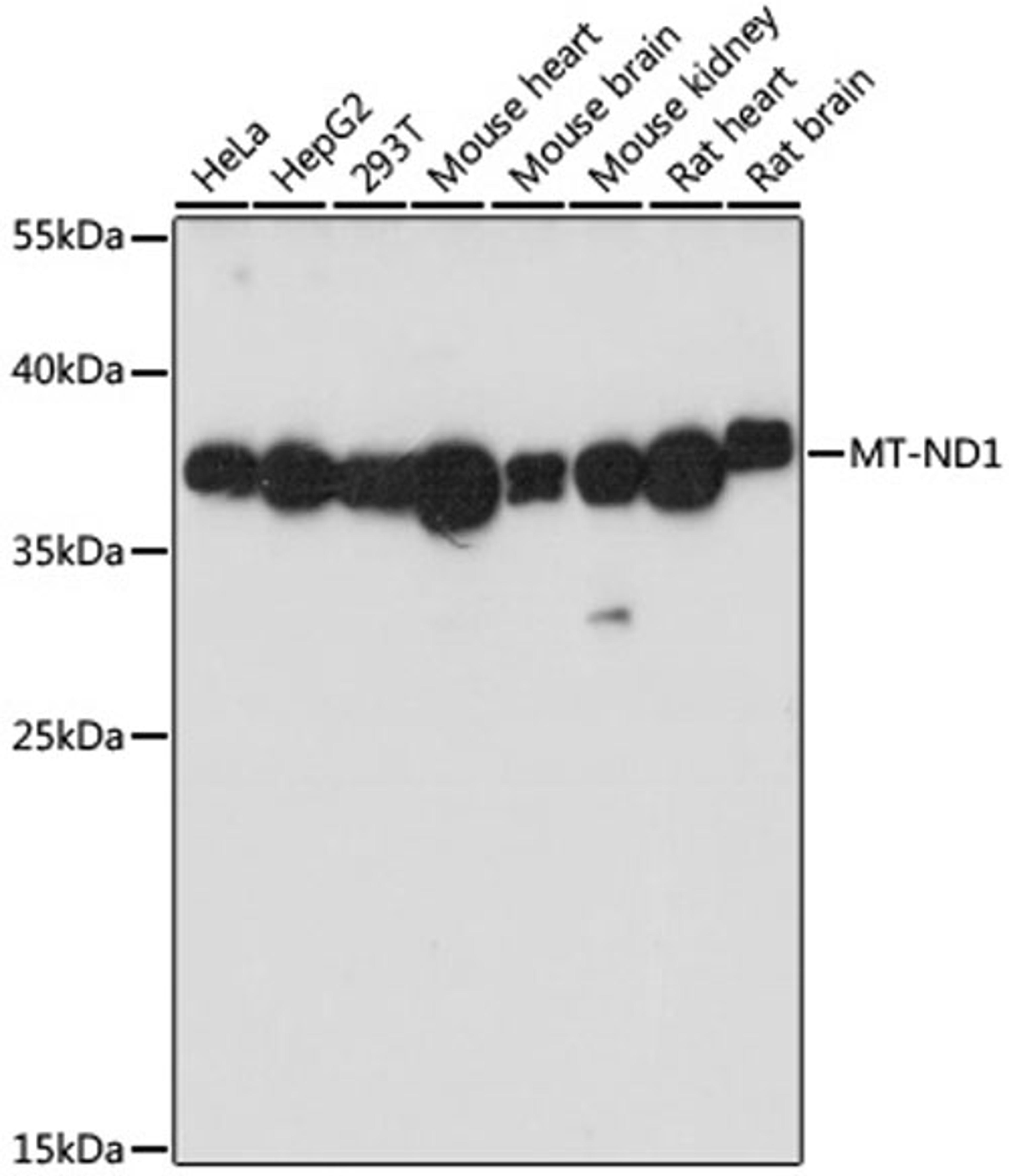 Western blot - MT-ND1 antibody (A17967)