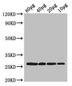 Western blot analysis of Rosseta bacteria lysate using 30S ribosomal protein S2 antibody