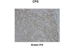 Immunohistochemistry: CPS1 Antibody [NBP1-54775] - Pig kidney Primary Antibody Dilution: 1 : 500 Secondary Antibody: Anti-rabbit-biotin, streptavidin-HRP Secondary Antibody Dilution: 1 : 500Color/Signal Descriptions: Brown: CPS Gene name: CPS1 Submitted by: Juan C. Mari, USDA/ARS Children's Nutrition Research Center Baylor College of Medicine.