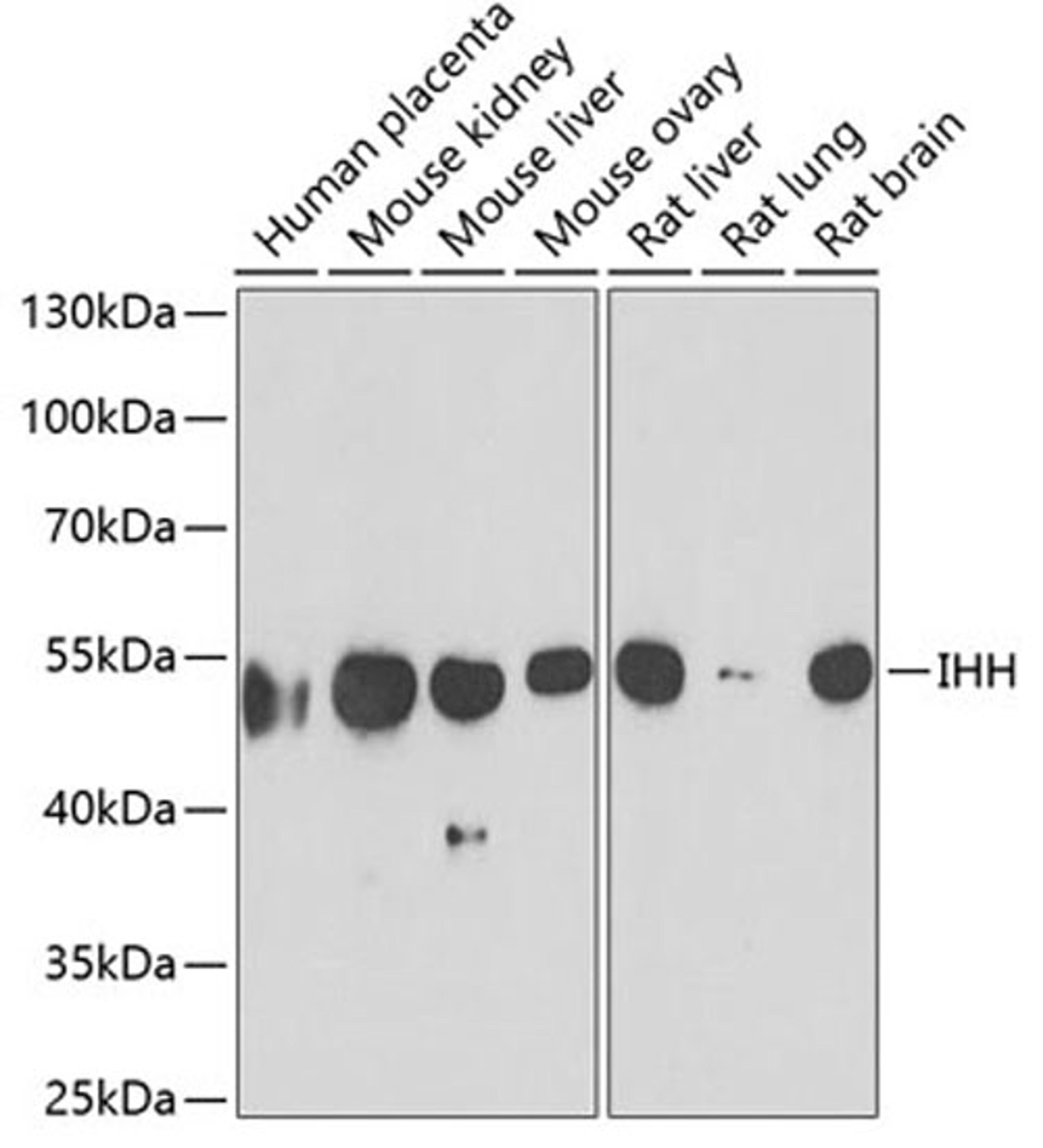 Western blot - IHH antibody (A6626)