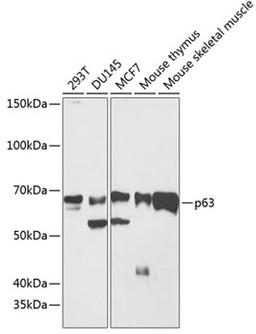 Western blot - p63 antibody (A19652)