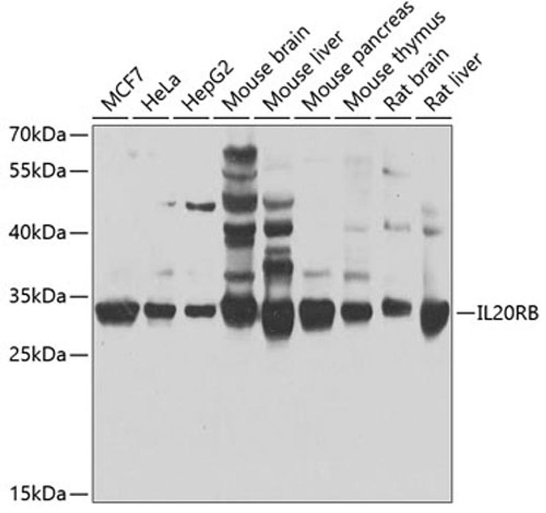 Western blot - IL20RB antibody (A7980)