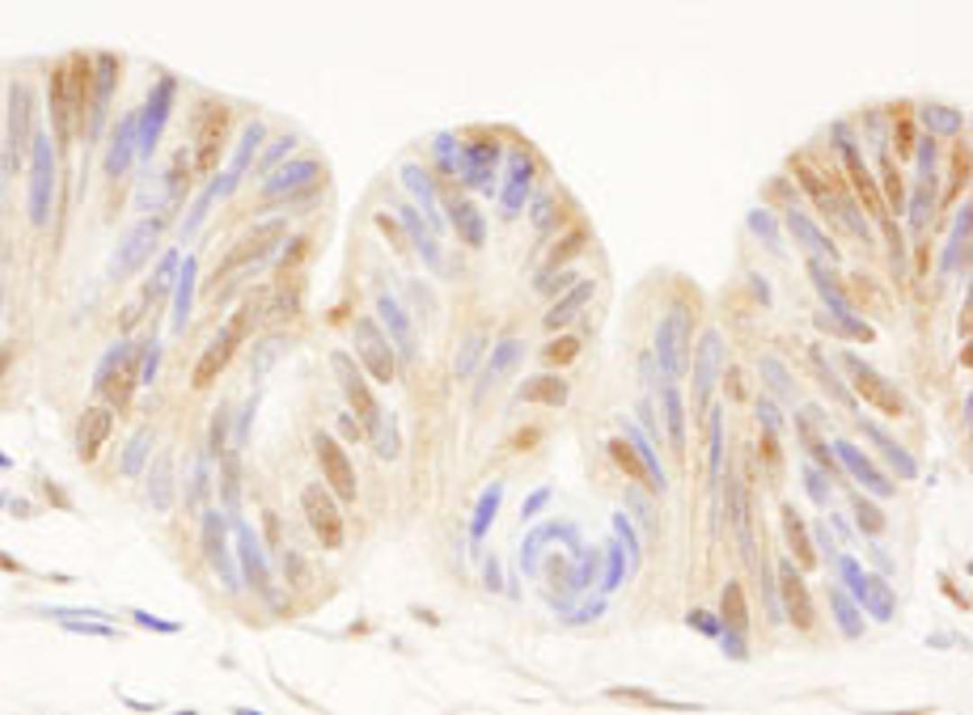 Detection of human CDC25c by immunohistochemistry.