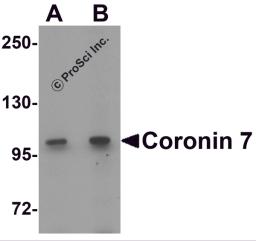 Western blot analysis of Coronin 7 in rat lung tissue lysate with Coronin 7 antibody at (A) 1 and (B) 2 μg/mL.