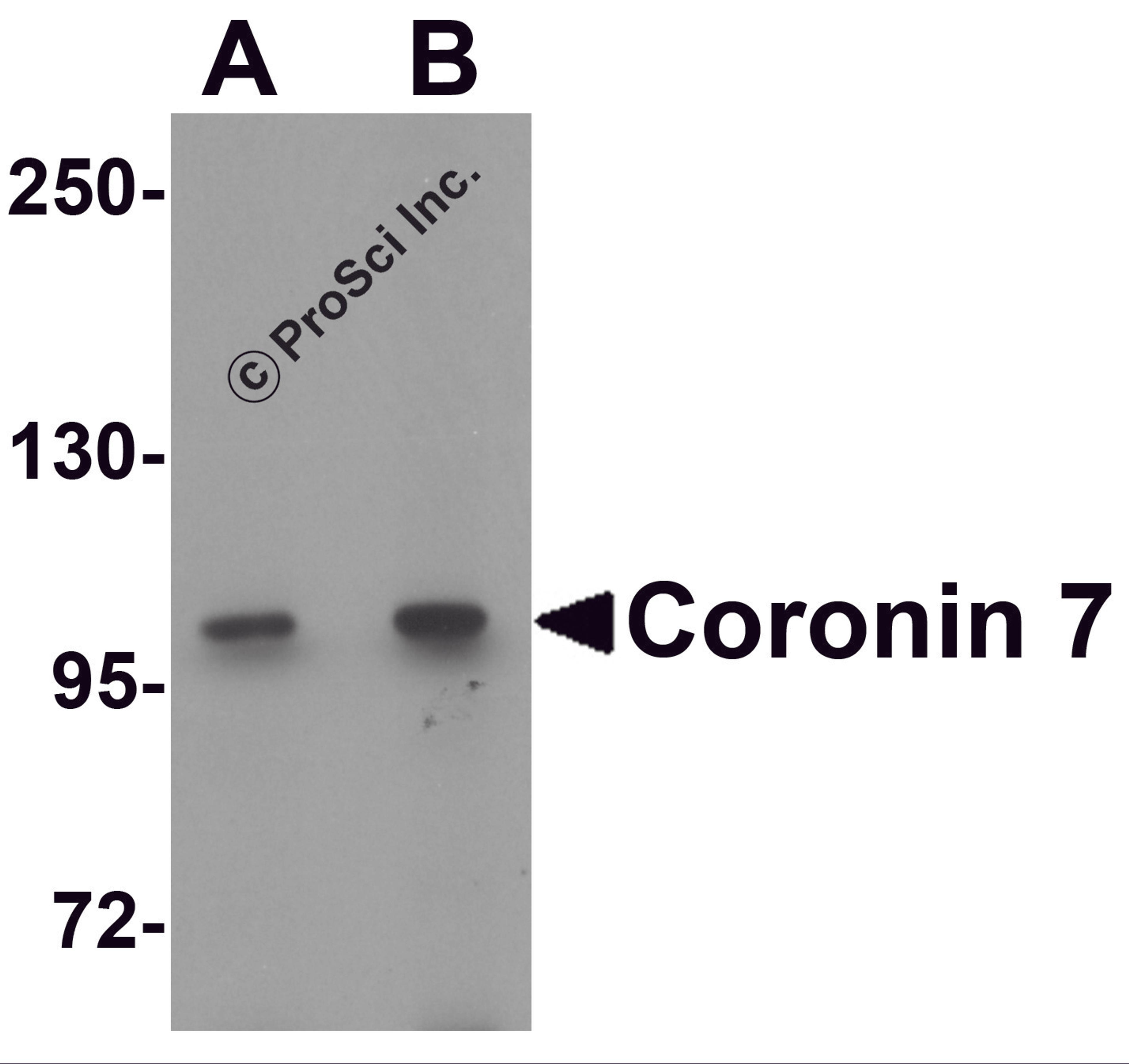 Western blot analysis of Coronin 7 in rat lung tissue lysate with Coronin 7 antibody at (A) 1 and (B) 2 μg/mL.