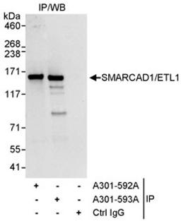 Detection of human SMARCAD1/ETL1 by western blot of immunoprecipitates.