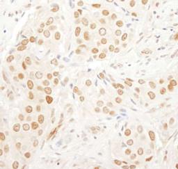 Detection of human PAF49 by immunohistochemistry.