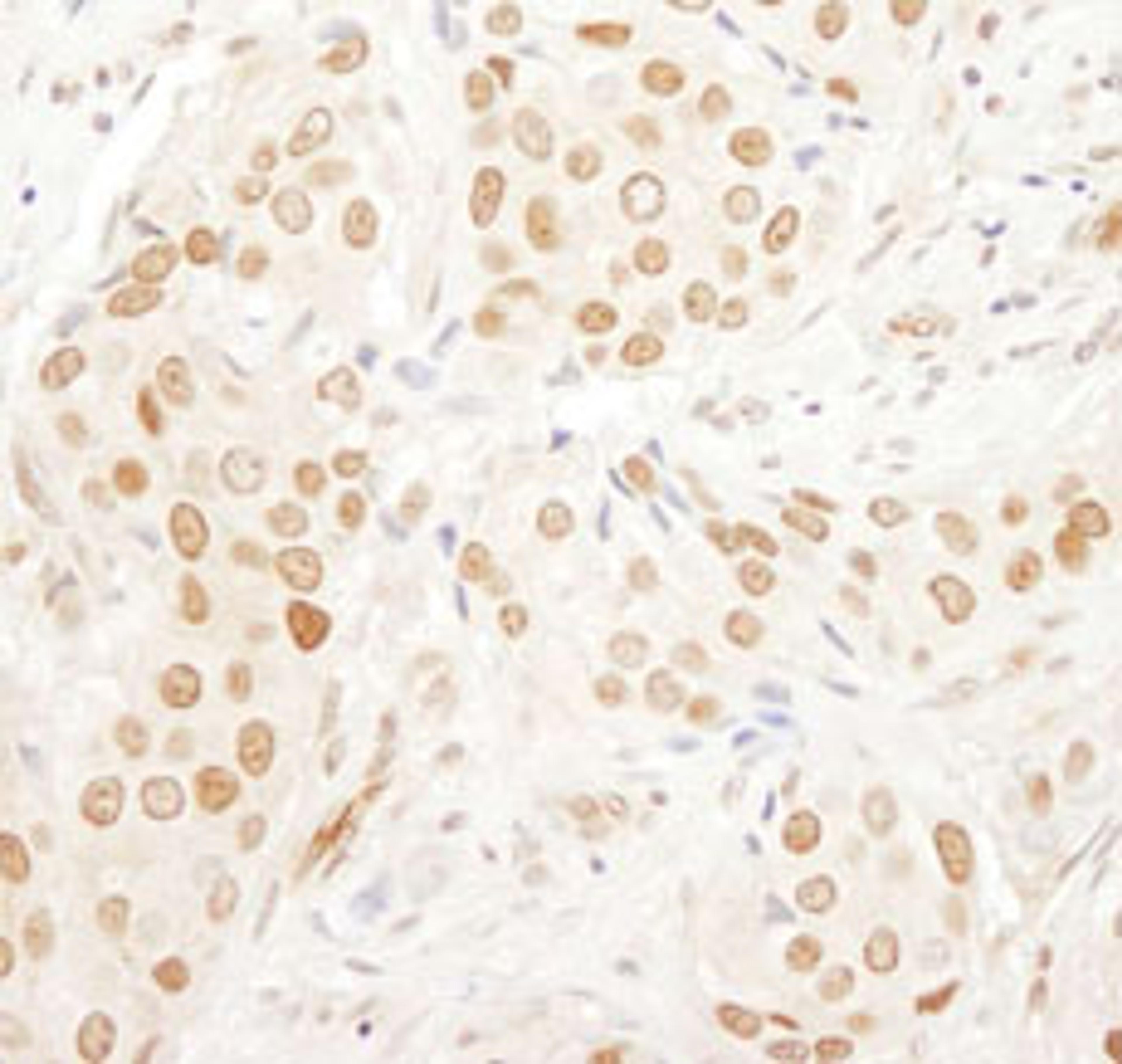 Detection of human PAF49 by immunohistochemistry.