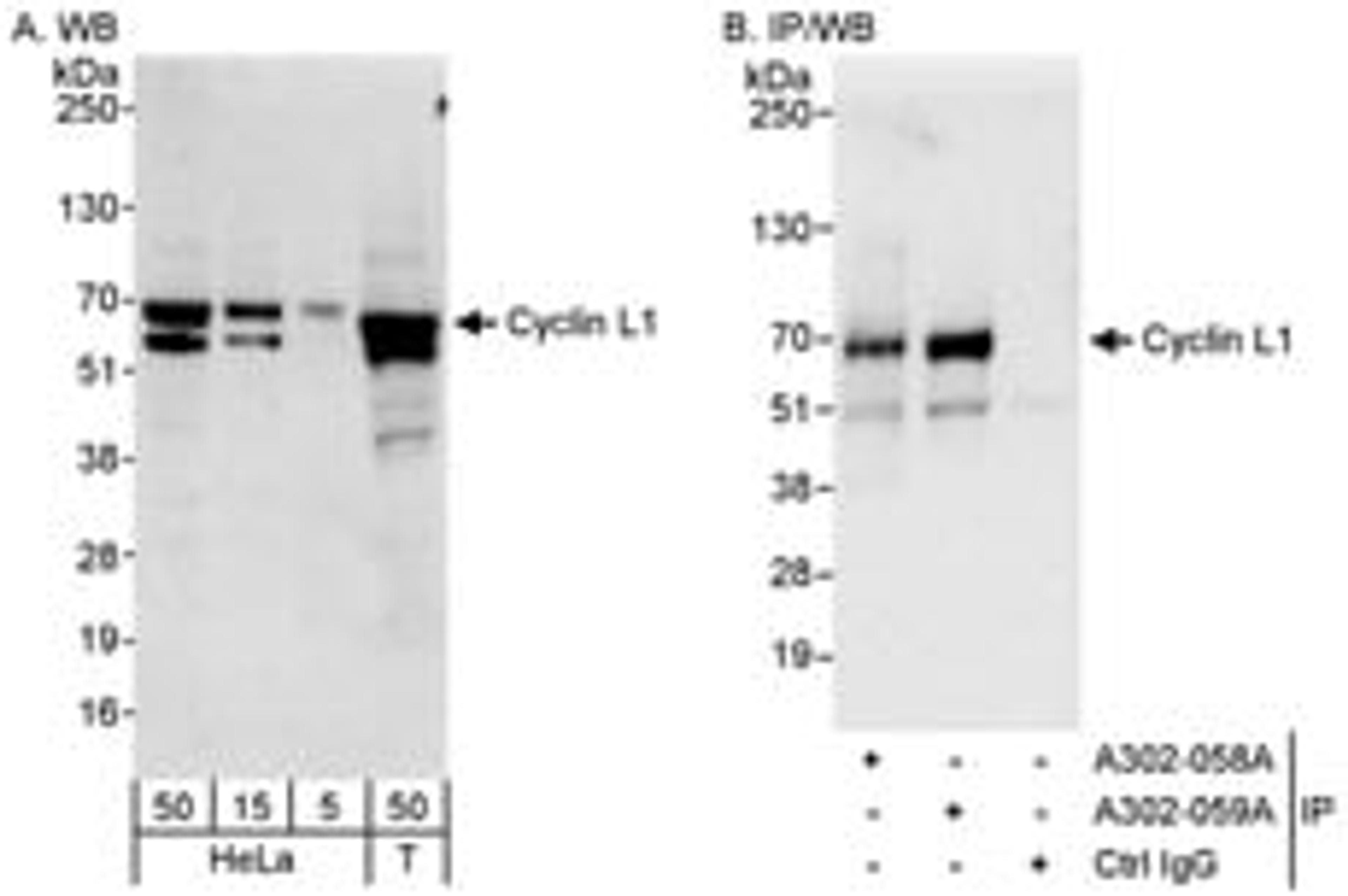 Detection of human Cyclin L1 by western blot and immunoprecipitation.