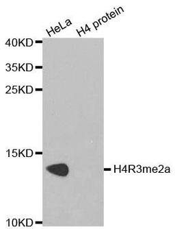 Western blot analysis of extracts of HeLa cell line and H4 protein expressed in E.coli using HIST2H4A antibody