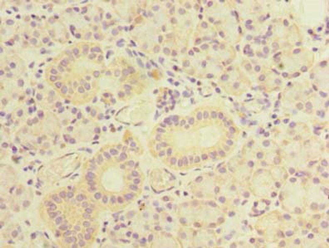 Immunohistochemistry of paraffin-embedded human pancreatic tissue using CSB-PA724138LA01HU at dilution of 1:100