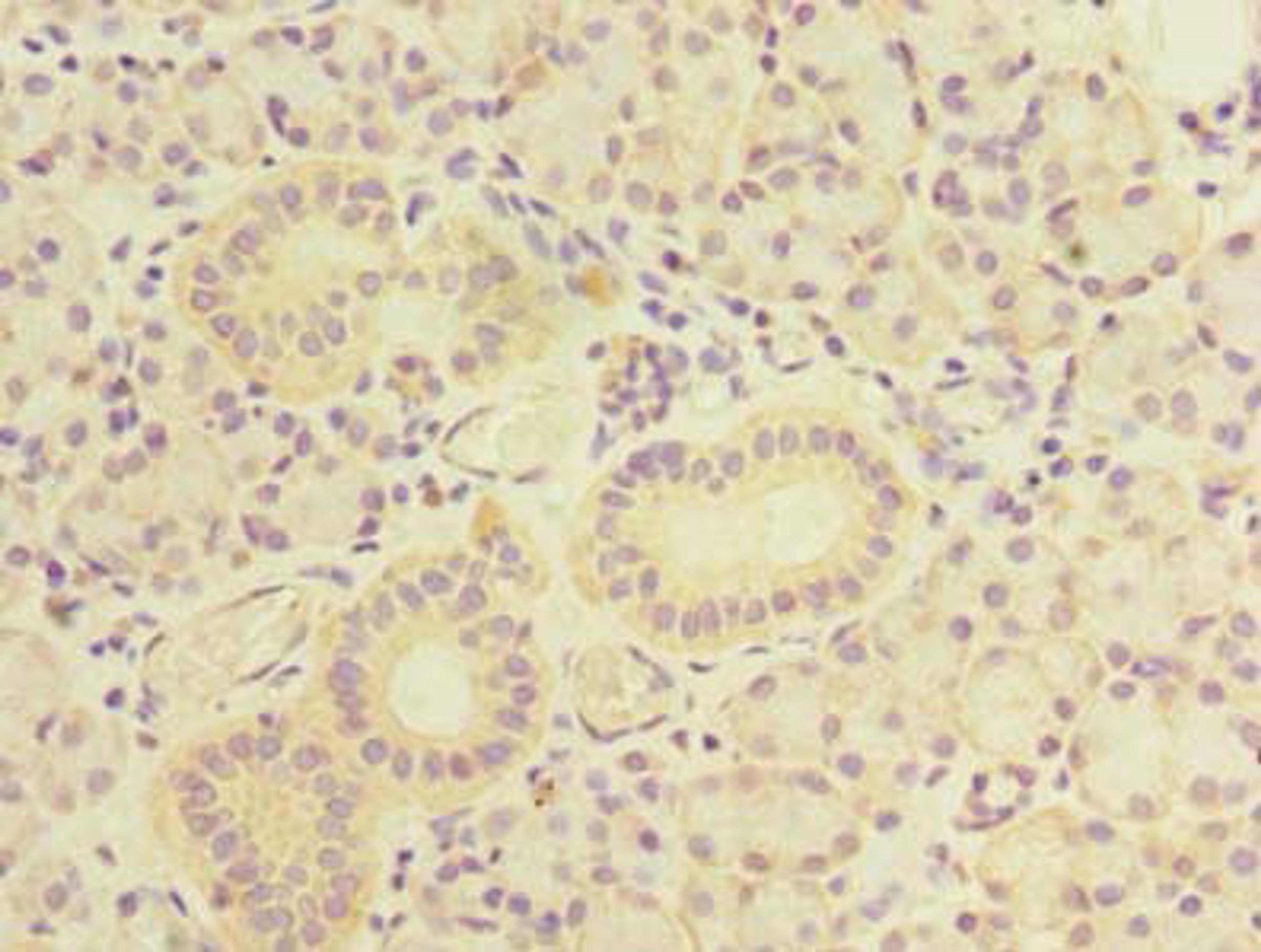 Immunohistochemistry of paraffin-embedded human pancreatic tissue using CSB-PA724138LA01HU at dilution of 1:100