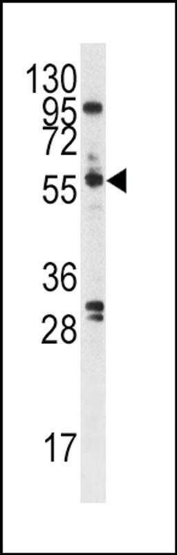 Western blot analysis of anti-PLK Pab in A375 cell lysate