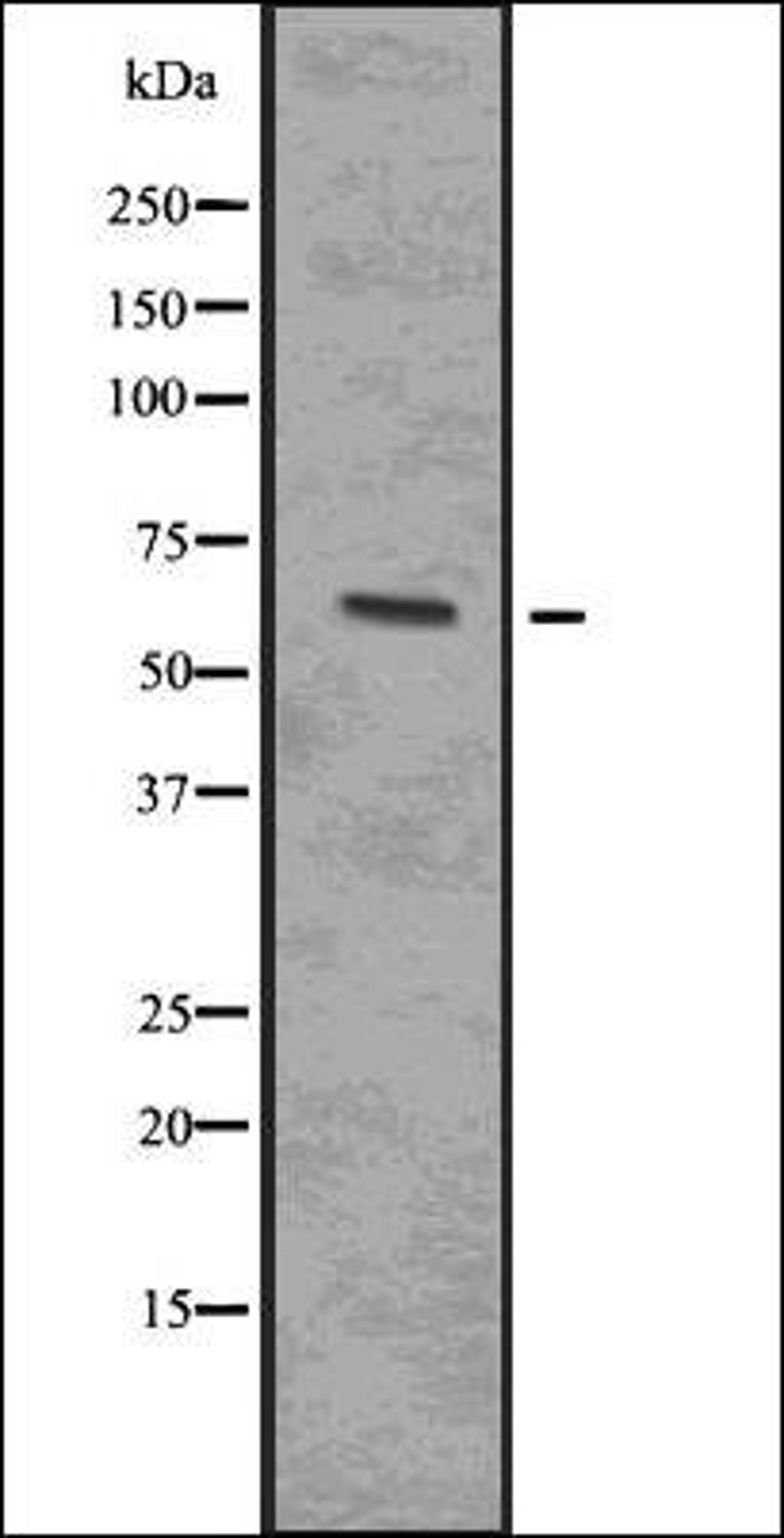 Western blot analysis of 293 whole cell lysates using IRAK4 -Phospho-Thr345/Ser346- antibody