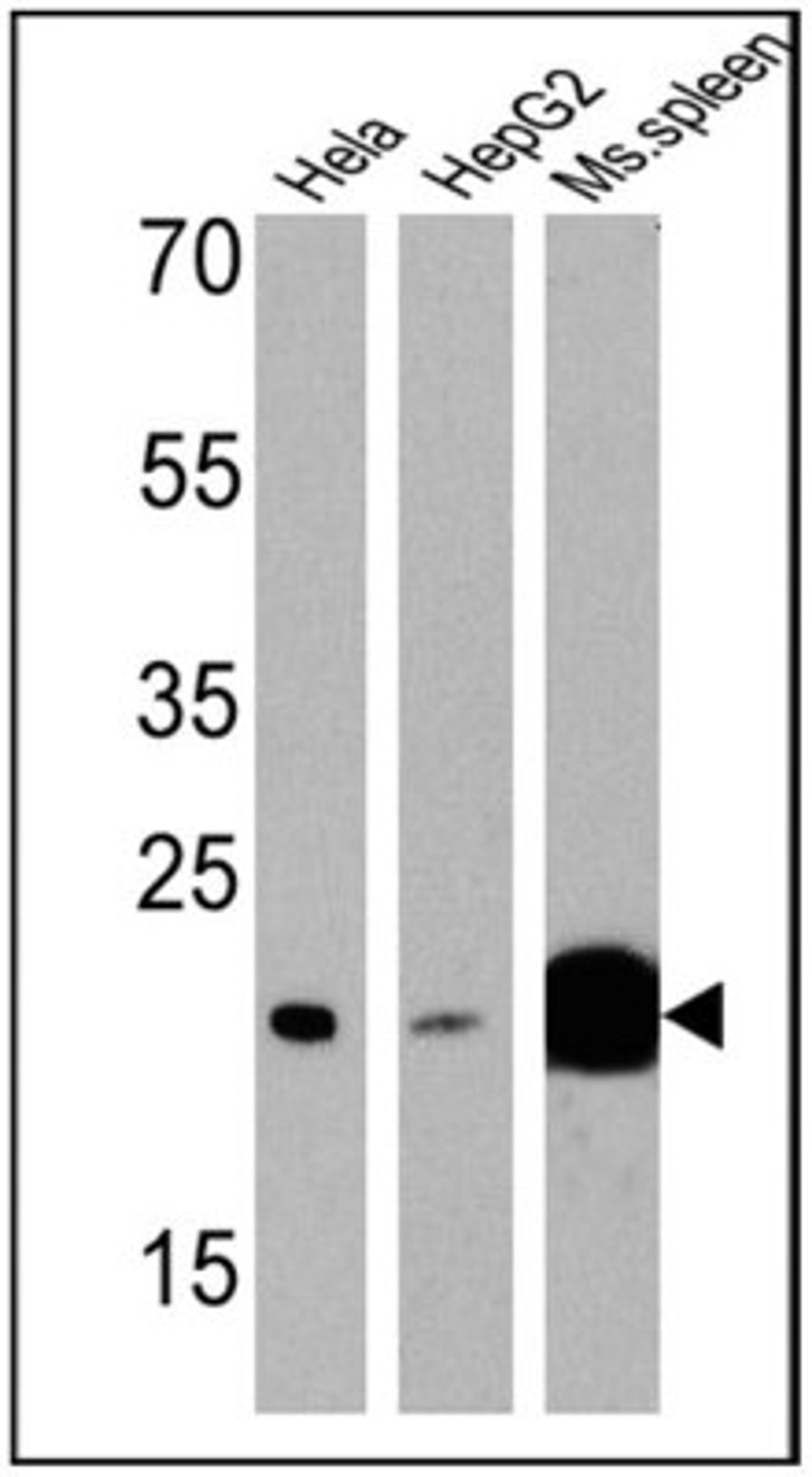 Western Blot: p23/PTGES3 Antibody (JJ3) [NB300-576] - Analysis of 25 ug of Hela (Lane 1), HepG2 (Lane 2), and mouse spleen cell lysates (Lane 3) and a molecular weight protein ladder.