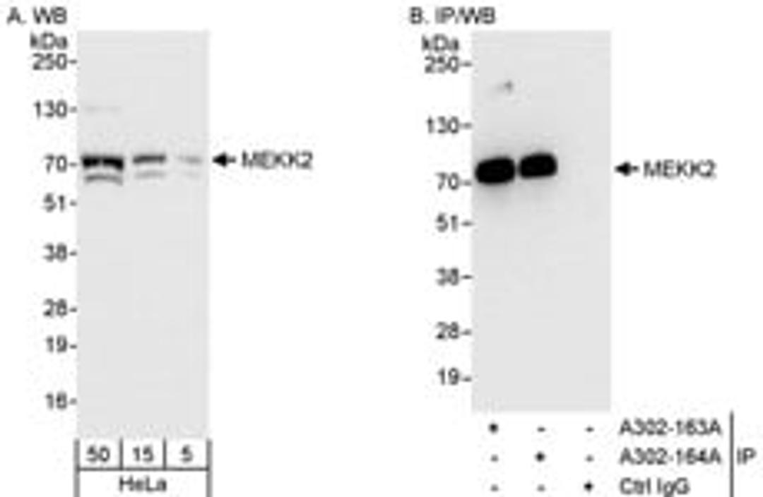 Detection of human MEKK2 by western blot and immunoprecipitation.