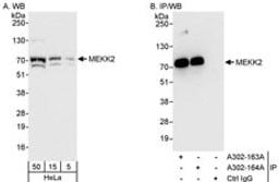 Detection of human MEKK2 by western blot and immunoprecipitation.