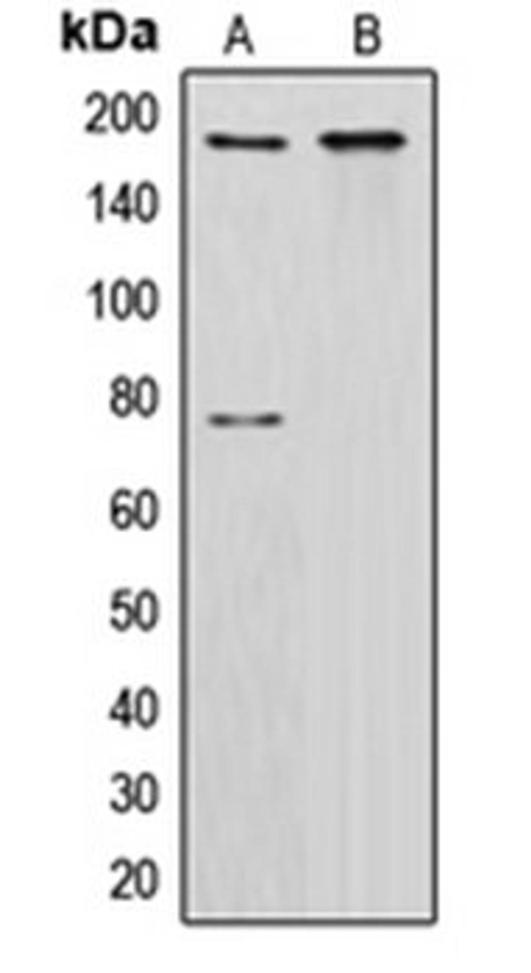 Western blot analysis of HeLa (Lane 1), NIH3T3 (Lane 2) whole cell lysates using CUX1 antibody