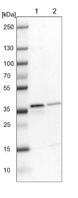 Western Blot: ELOVL7 Antibody [NBP1-93926] - Lane 1: NIH-3T3 cell lysate (Mouse embryonic fibroblast cells)<br/>Lane 2: NBT-II cell lysate (Rat Wistar bladder tumour cells)