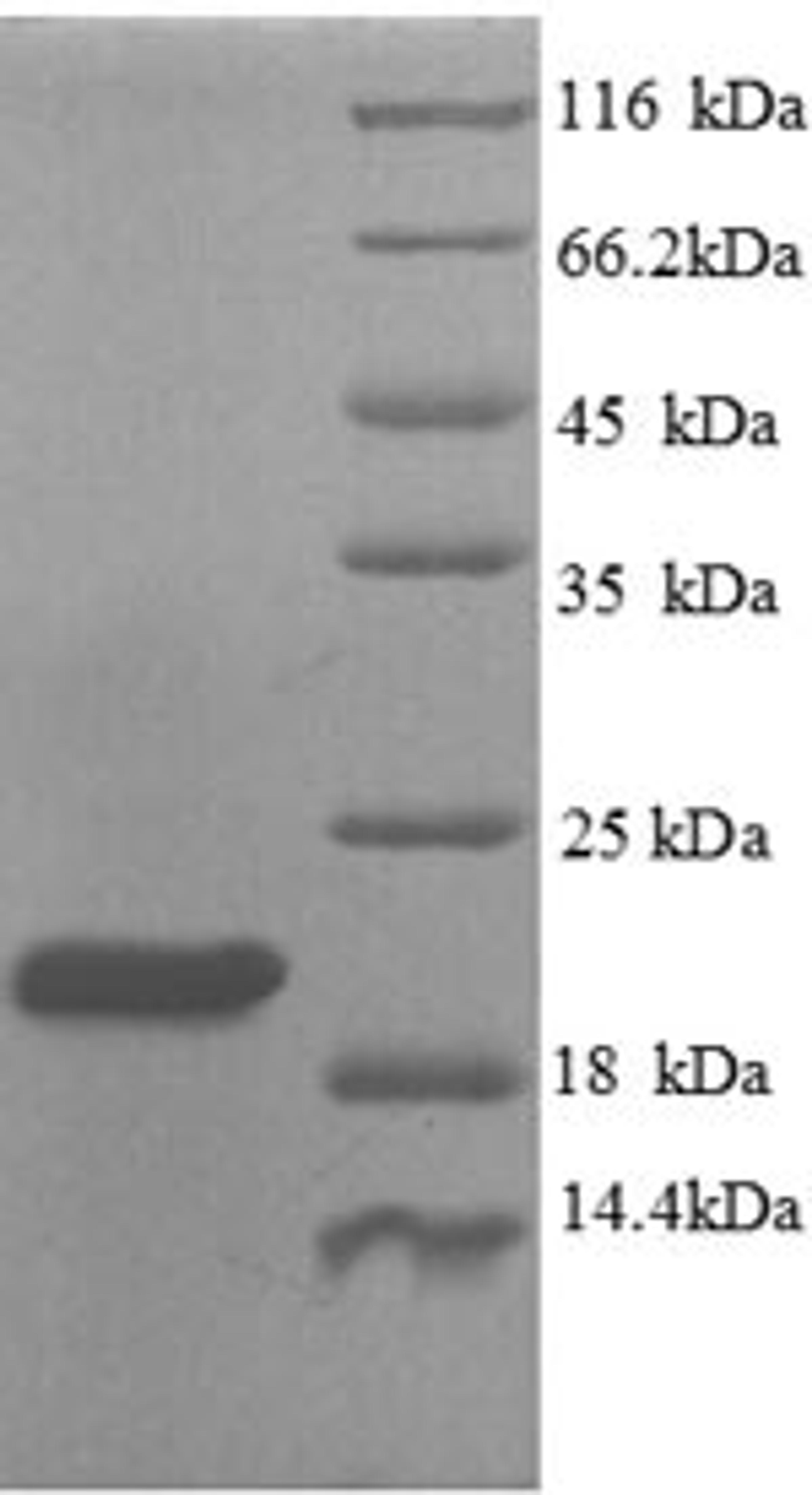(Tris-Glycine gel) Discontinuous SDS-PAGE (reduced) with 5% enrichment gel and 15% separation gel.